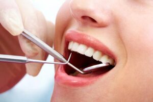 Dental Cleaning - Spokane Family Dental